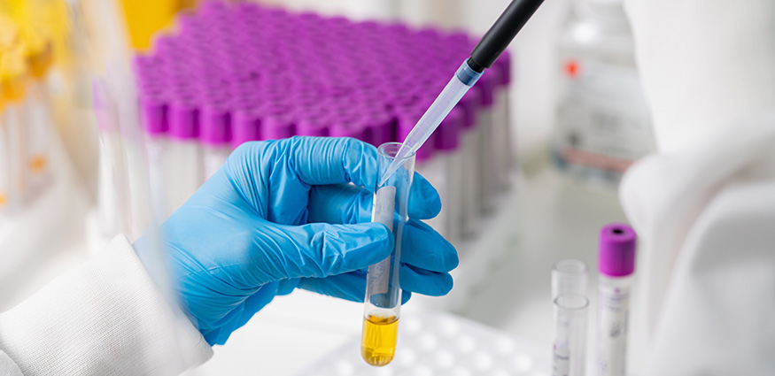 Lab technician Analyzing Cannabinoids.